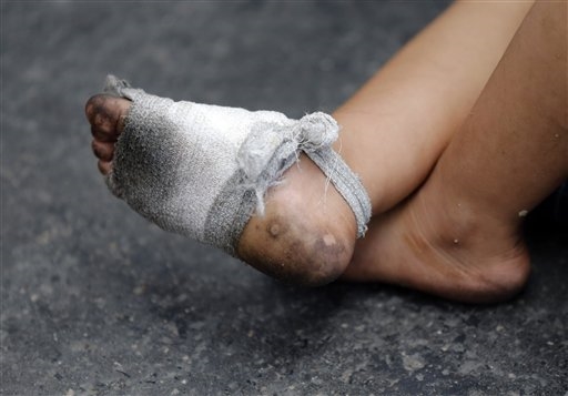 I piedini bendati di un bambino in viaggio a piedi verso la Germania