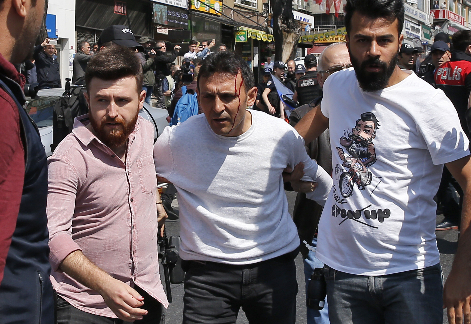 Turkish police officers in plain clothes detain a wounded demonstrator, during May Day protests in Istanbul, Tuesday, May 1, 2018. Police in Istanbul detained dozens of demonstrators who tried to march toward Istanbul's symbolic Taksim Square in defiance of a ban by the government, citing security concerns. (AP Photo/Lefteris Pitarakis)