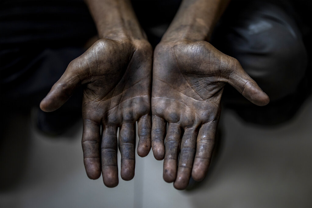 A child laborer displays his hands after being rescued in a raid by Bachpan Bachao Andolan, or Save the Childhood Movement, at a garage in New Delhi, India, Thursday, Aug. 26, 2021. Police accompanied by activists of the children’s rights group on Thursday raided automobile repair shops on the edge of the Indian capital, rescuing 17 children illegally employed as daily wage workers. Activists from Bachpan Bachao Andolan, whose founder Kailash Satyarthi won the Nobel Peace Prize in 2014, went from one repair shop to another, freeing children whose hands, clothes and feet were smeared with grease. (AP Photo/Altaf Qadri)