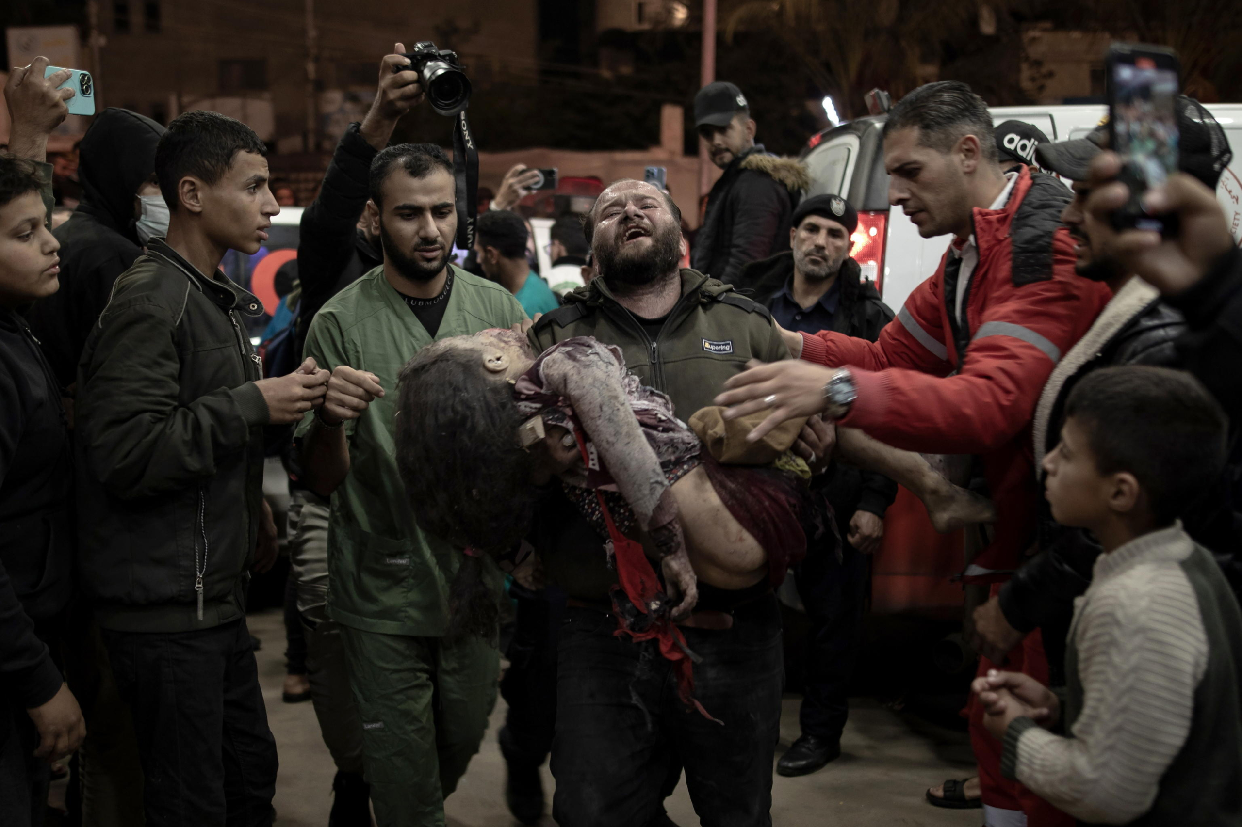 Un uomo trasporta una bambina ferita all'ospedale Nasser di Khan Yunis, nel sud della Striscia di Gaza, il 6 gennaio 2024, a seguito degli attacchi aerei israeliani nel sud di Gaza. Foto: EPA/HAITHAM IMAD ATTENTION EDITORS: GRAPHIC CONTENT, via ANSA

