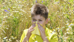Allergie, ne soffrono 3 italiani su 10