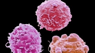 Cancro, le nuove cure premiate col Nobel