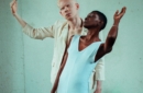Il rischio di essere albino in Malawi
